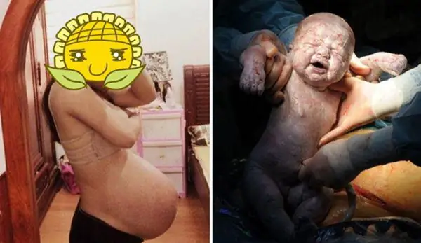Bụng Tụt Khi Mang Thai: Dấu Hiệu Sắp Sinh, Thời Gian Và Những Điều Mẹ Cần Biết