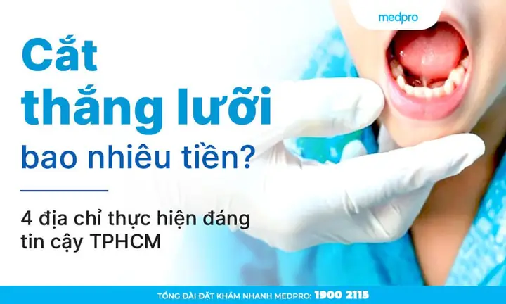 Cắt Thắng Lưỡi Cho Bé Bao Nhiêu Tiền? Chi Phí & Kinh Nghiệm Cần Biết Cắt Thắng Lưỡi Cho Bé Bao Nhiêu Tiền? Chi Phí & Kinh Nghiệm Cần Biết