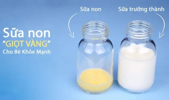Có Nên Bổ Sung Sữa Non Cho Trẻ Sơ Sinh Không? Lợi Ích, Lưu Ý Quan Trọng Có Nên Bổ Sung Sữa Non Cho Trẻ Sơ Sinh Không? Lợi Ích, Lưu Ý Quan Trọng