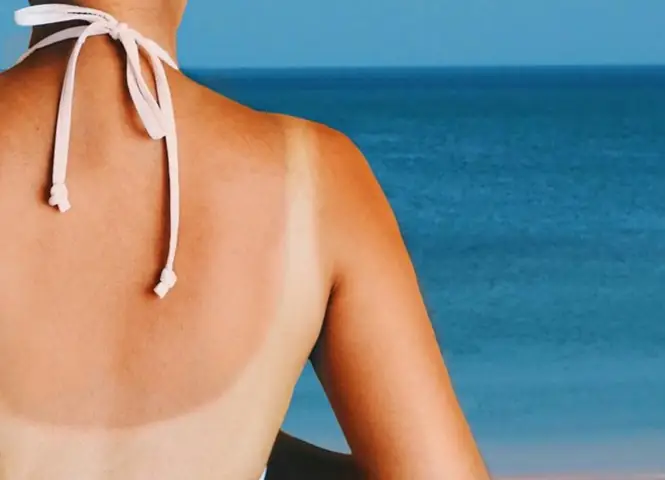 15+ Cách Dưỡng Trắng Da An Toàn & Phục Hồi Da Sạm Nắng Sau Khi Tắm Biển