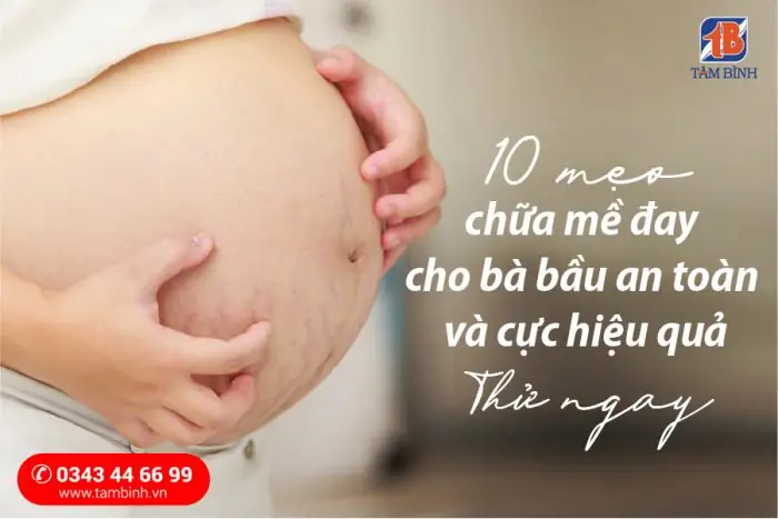 Mẹo Chữa Mề Đay Cho Bà Bầu An Toàn, Hiệu Quả Tại Nhà Mẹo Chữa Mề Đay Cho Bà Bầu An Toàn, Hiệu Quả Tại Nhà