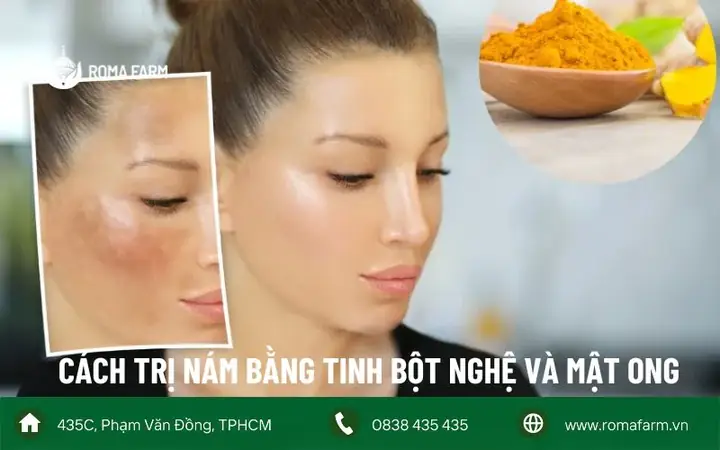 Mặt Nạ Trị Nám Bằng Mật Ong Và Nghệ: Công Thức Hiệu Quả, An Toàn Tại Nhà Mặt Nạ Trị Nám Bằng Mật Ong Và Nghệ: Công Thức Hiệu Quả, An Toàn Tại Nhà