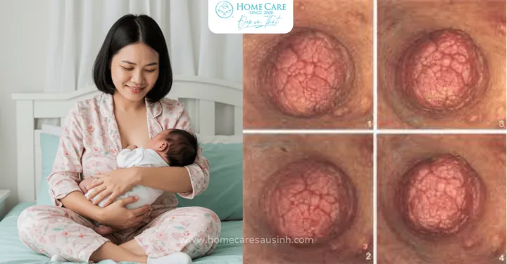 Việc Ba-ti-mê "bước Theo Đức Giê-su Trên Đường" Tượng Trưng Cho Điều Gì? Việc Ba-ti-mê "bước Theo Đức Giê-su Trên Đường" Tượng Trưng Cho Điều Gì?